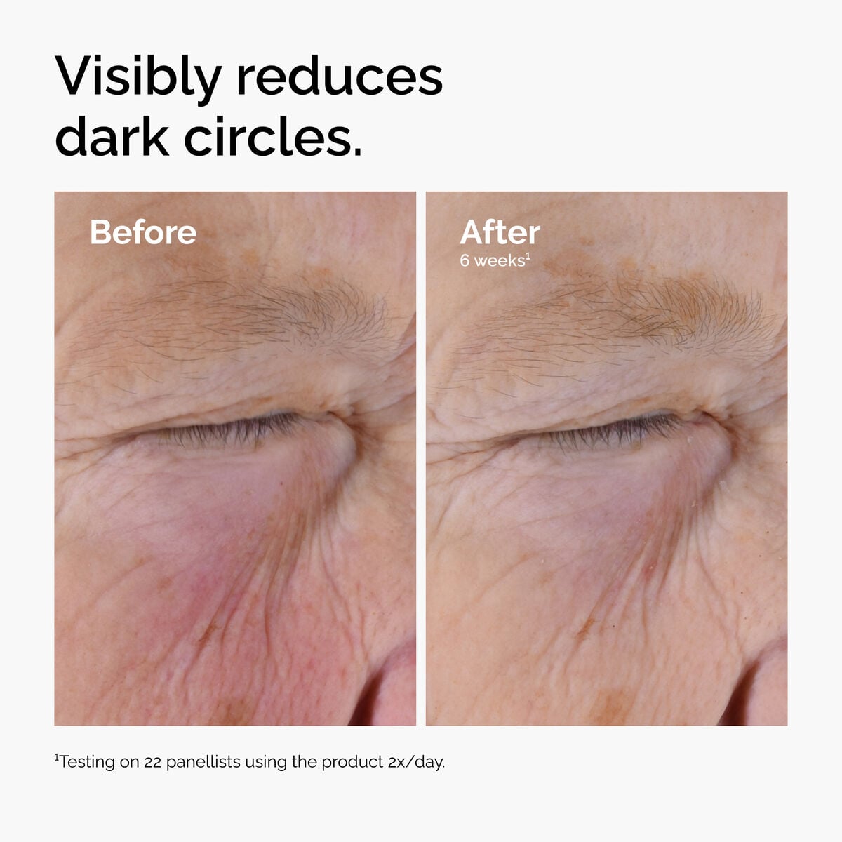caffeine-solution-5-egcg-eye-serum-v2 ord-caffeine-solution-egcg-dark-circles-before-after.jpg