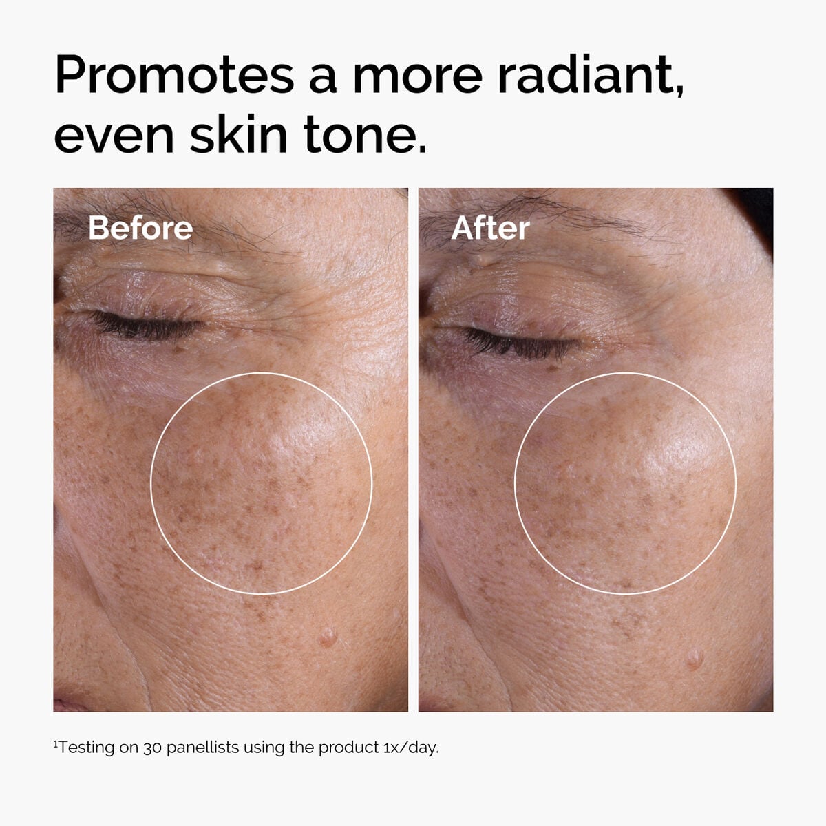 glycolic-acid-7-exfoliating-toner-c9 ord-glycolic-before-after-radiance.jpg