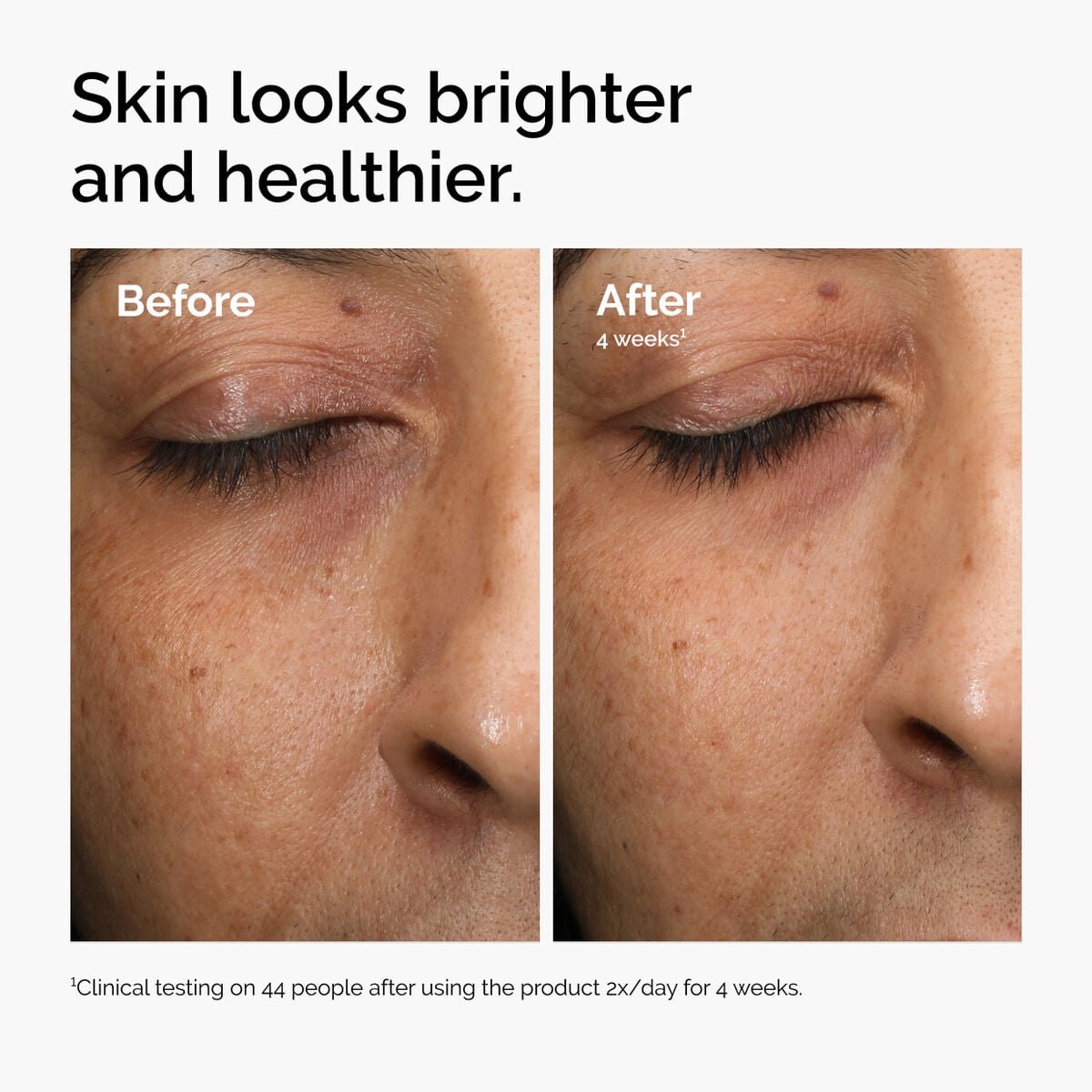 multi-antioxidant-radiance-serum-t3 ord-mars-before-after-healthy.jpg