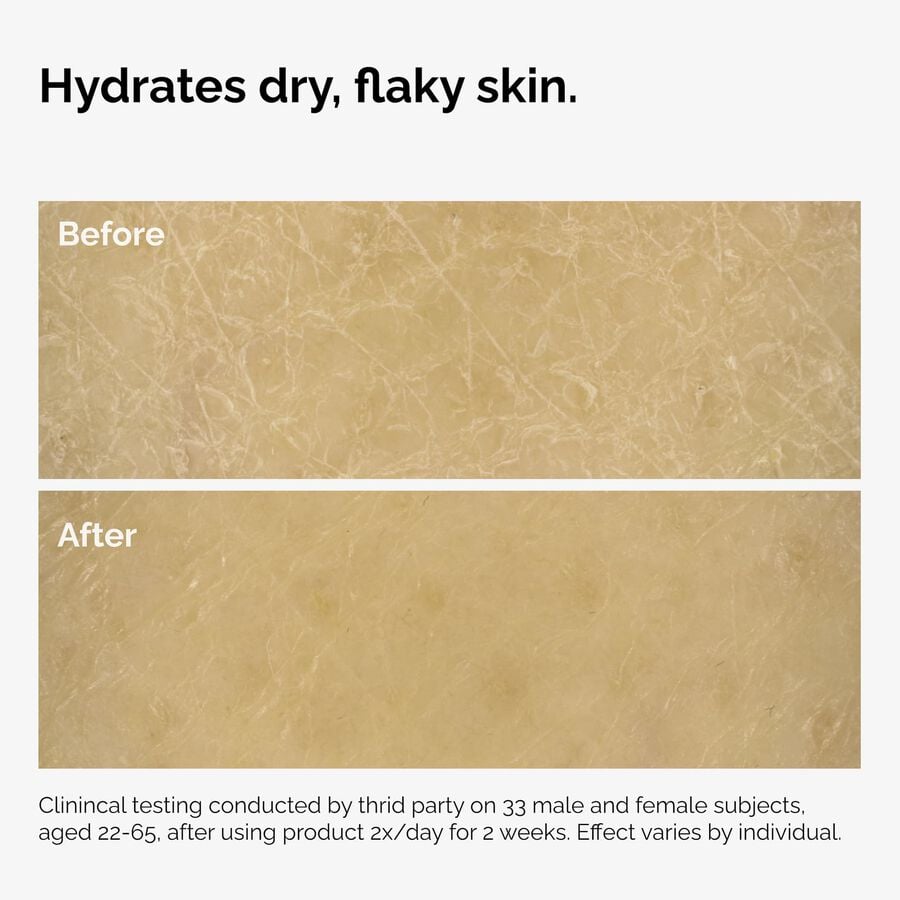 the-body-care-collection-r0 ord-natural-moisturizing-factors-inulin-body-before-after-graphic-02.jpg